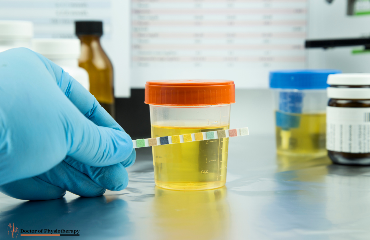 Can Labs Tell the Difference Between Real and Synthetic Urine? Doctor